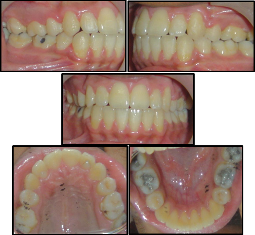 Post treatment intraoral photographs