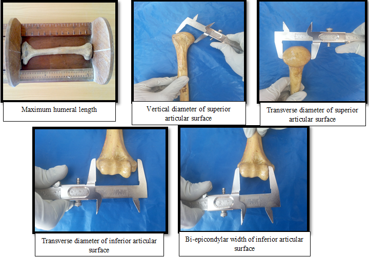 Figures showing the procedure of measuring the dimensions.