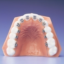 Kelly Bracket: Horizontal insertion bracket