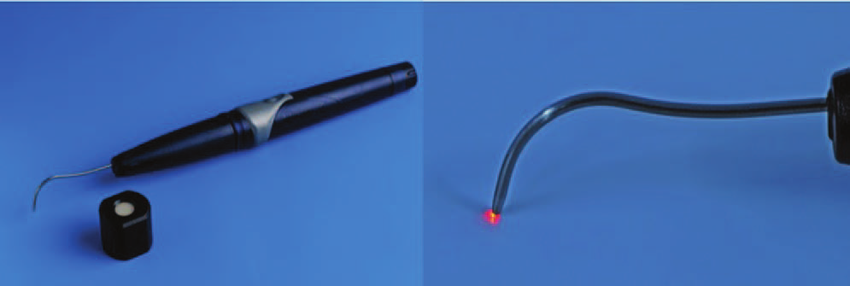 Midwest Caries I.D. (Pic courtesy:- www.researchgate.net)