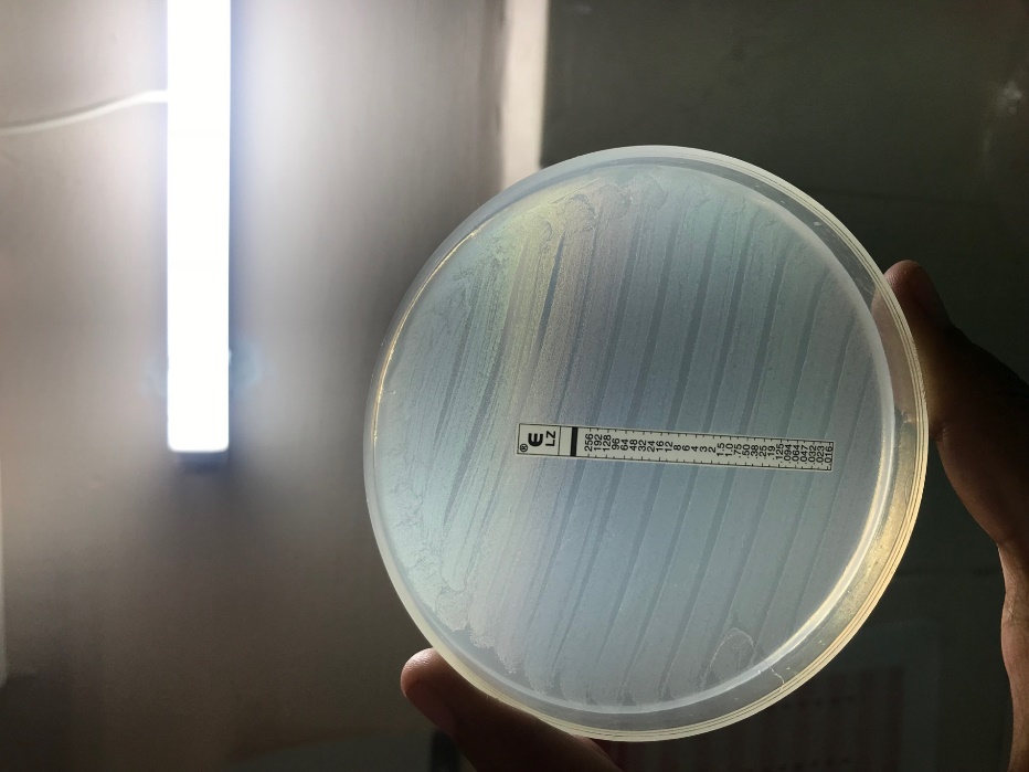 The antibiotic susceptibility testing on MHA plate showing no zone of inhibition around the linezolid E-test strip