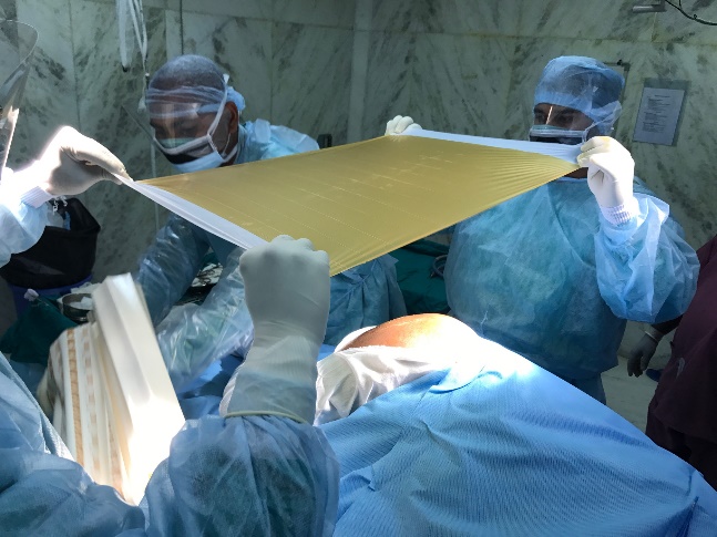 Applying I-O Ban over incision site