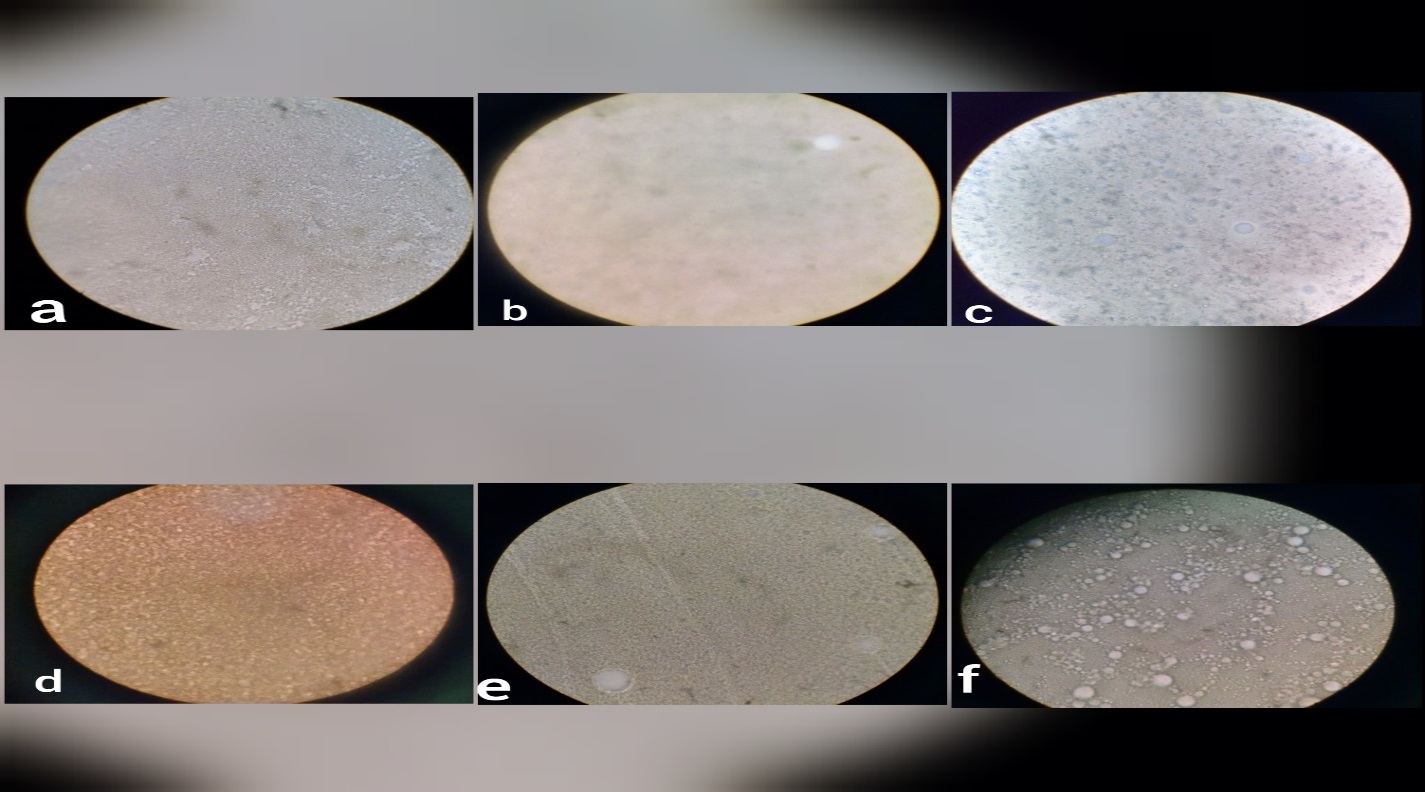 Microscopic vision of vaccine’s stability at different temperatures (a; 2°C b; 4°C c; 8°C d; 12°C e; 16°C f; 20°C)