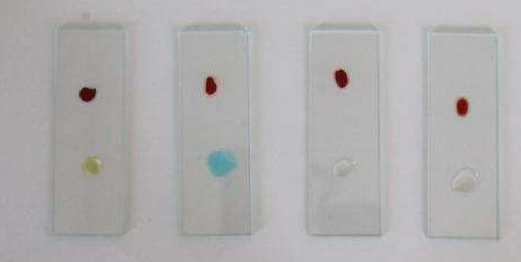 Reagents and patient blood in glass slide