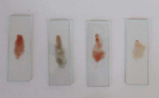 Agglutination
