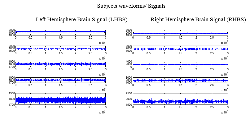 #. Sub thalamic nucleus STN neurons of the patient A1