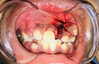 Post operative view