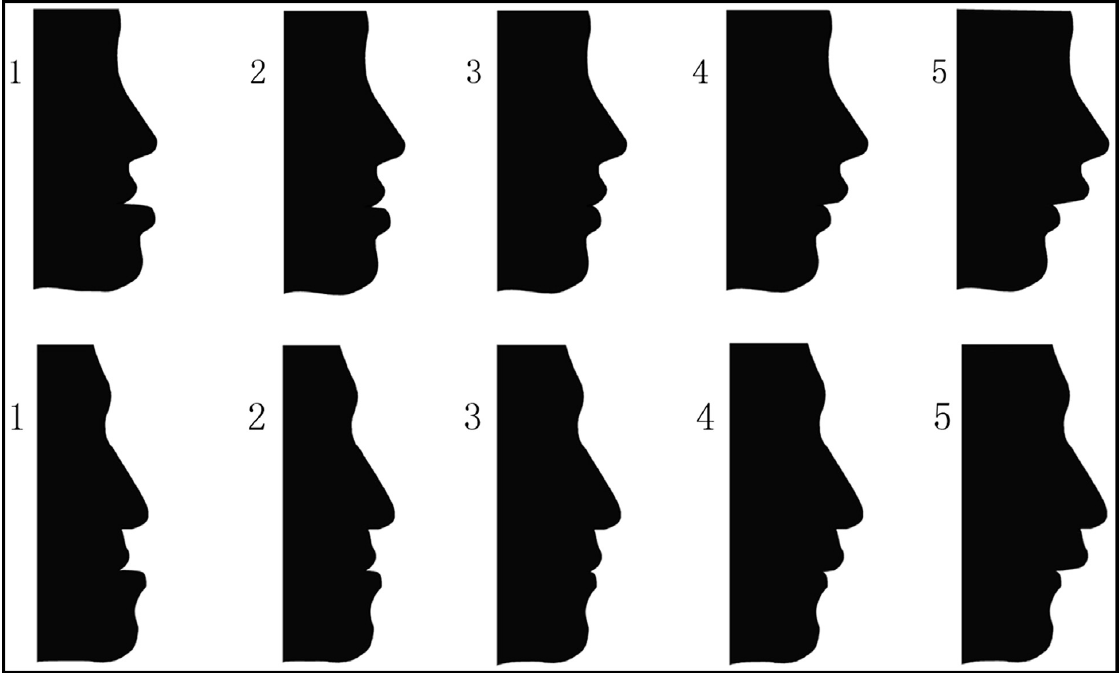 Pogonion manipulations of the female (upper) and the male (lower) straight facial profile images. From left to right: 1) (protruded 12°), 2) (protruded 6°), 3) (straight), 4) (retruded 6°) and 5) (retruded 12°).