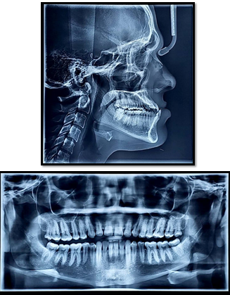 Pretreatment radiographs