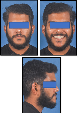 Post treatment extra oral records