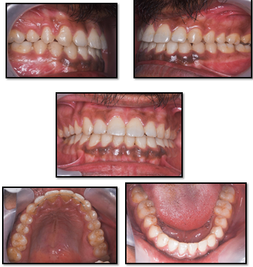 Post treatment intra oral records