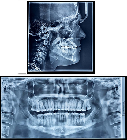 Post treatment radiographic records