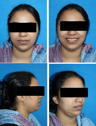 Pre-treatment extra-oral photographs.