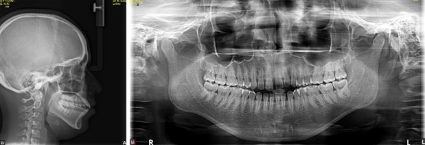 Pre-treatment radiographs