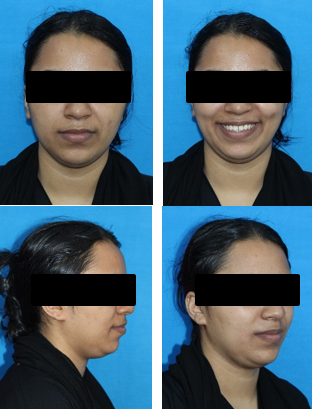 Post-treatment extra-oral photographs.