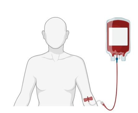 Whole blood bag collected from blood donor