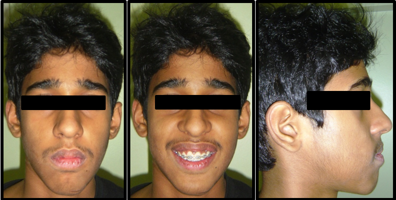 Treatment extraoral photographs