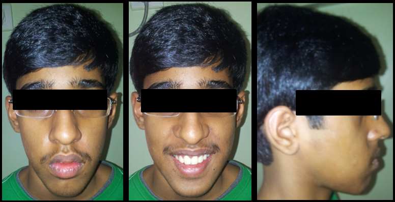 Post treatment extraoral photographs