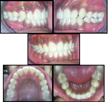 Post treatment intraoral photographs