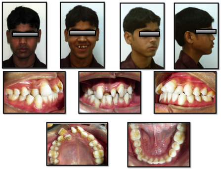 Pretreatment photographs