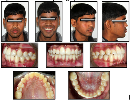Post-treatment photographs