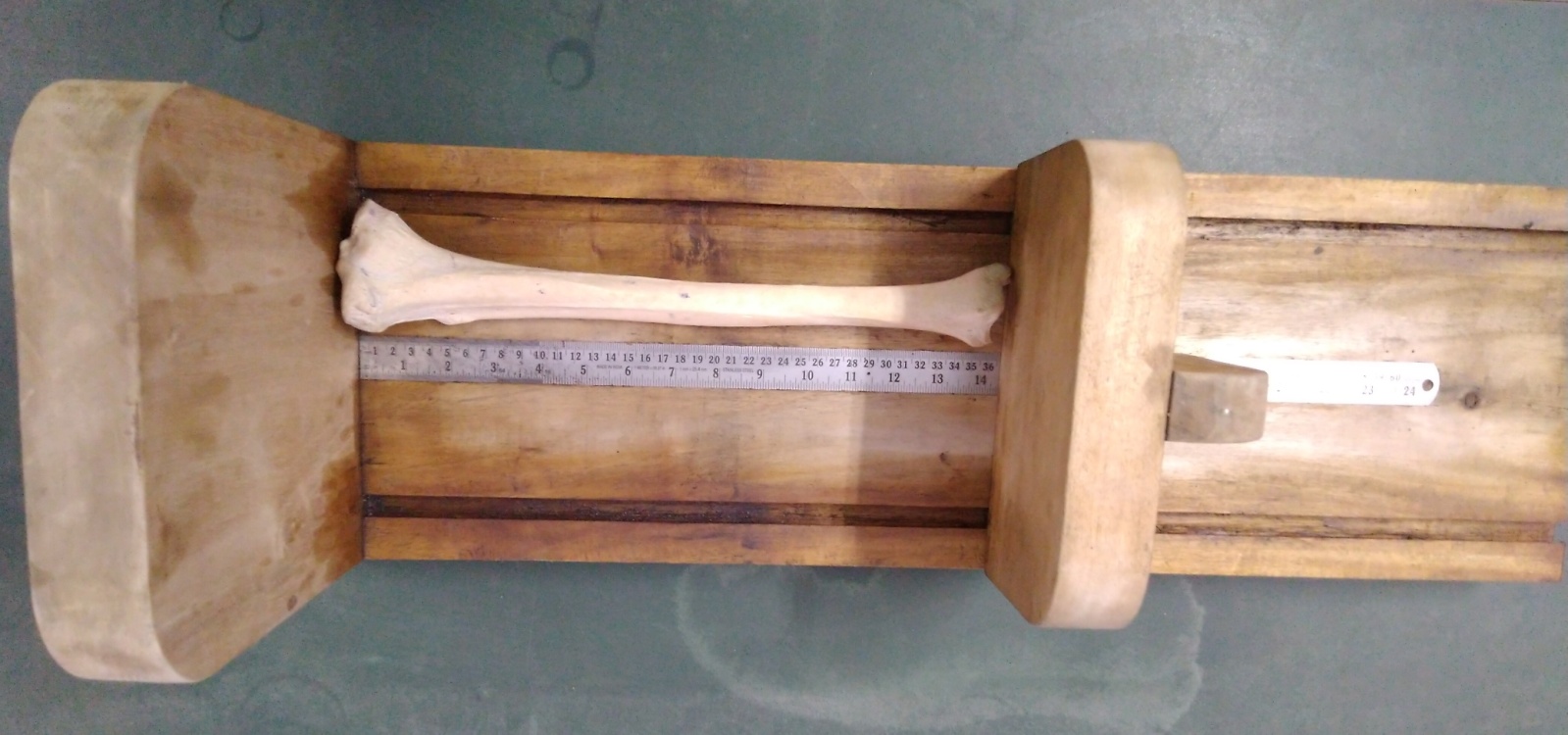 Measurement of lengths of bones usingosteometric boards