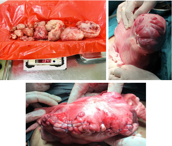 Case 1