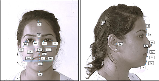 Anthropometric landmarks