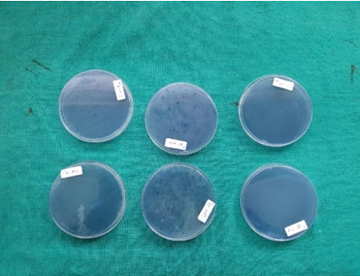 Sample plates after Incubation