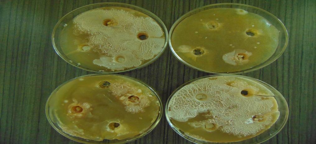Growth and inhibition of microbes. (Anti-Microbial Activity)