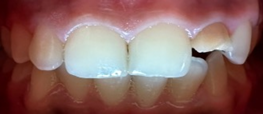 Pre-operative photograph 