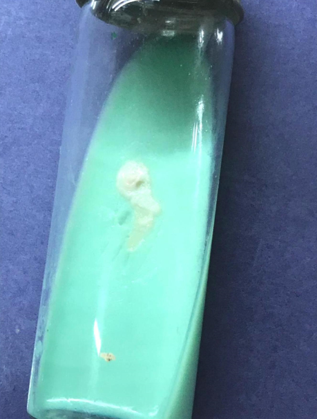 Buff coloured moist, non-pigmented colonies on LJ media