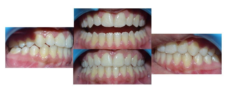 1 year follow up