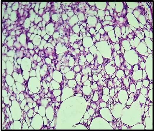 Microphotograph 40Xmagnification. H&E stain: Simple and complex annular tubules