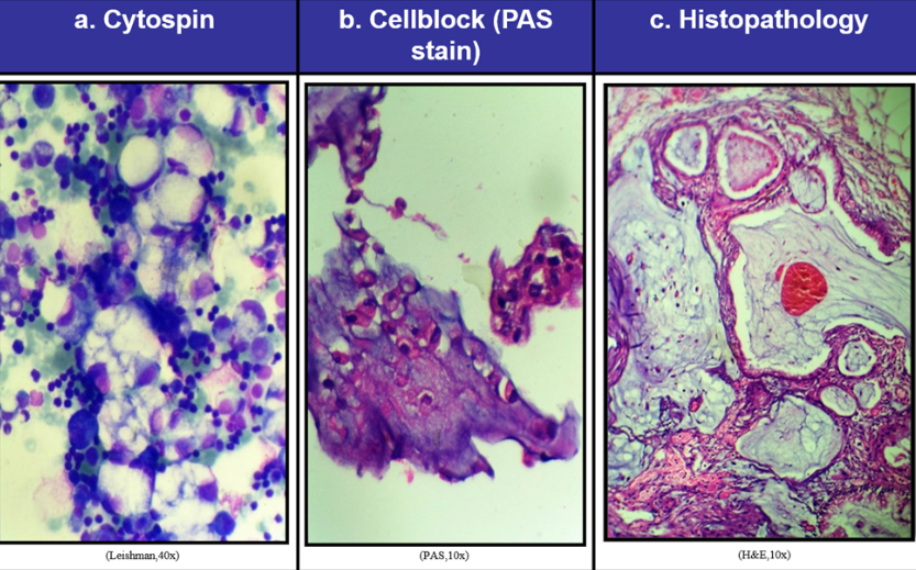 . The Biological bulletin. Biology; Zoology; Biology; Marine Biology. 358  MICHAEL J. SMITH. FIGURE 1. The blood cells of H. aiirantmm. Plates A (3000  X), B (3000 X), D 2000 X),. E (2000 X), and F (1250X) are photographs