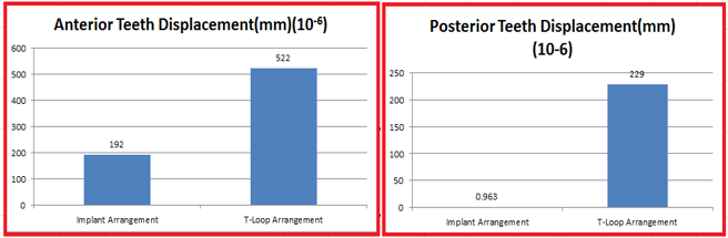 Comparison of anterior teeth displacement and posterior teeth displacement in implant and T loop arrangement.
