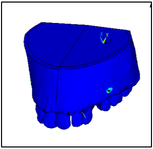 Software model showing PDL and teeth fitted into bone