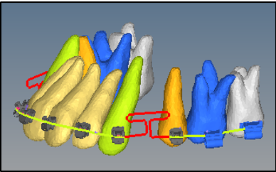 Centric position of T loop in continuous arch form