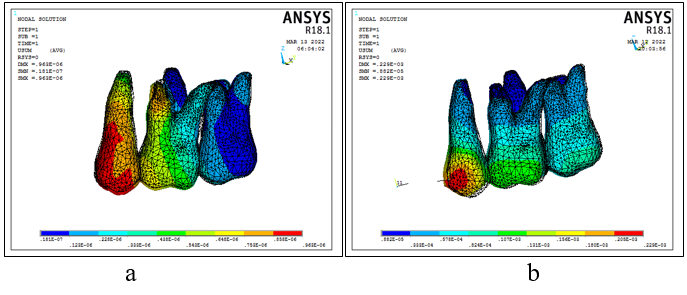 a & b : Posterior teeth displacement in Implant and T loop arrangement.