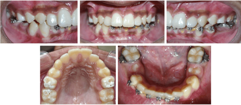 Post orthopedic intraoral photographs
