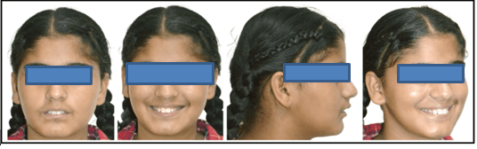 Post orthopedic extraoral photographs