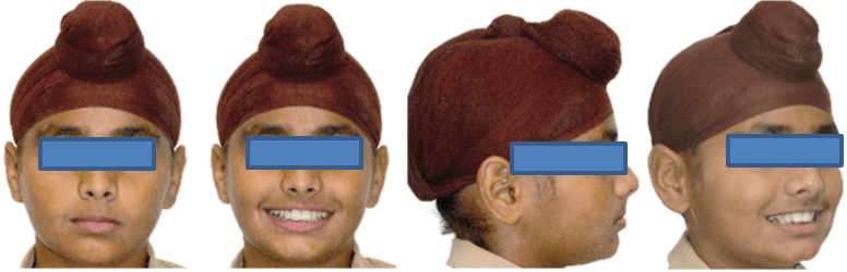 Post orthopedic extraoral photographs