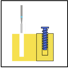 Self tapping screw (It requires pilot drilling before insertion)