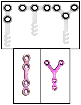 Types of miniplates