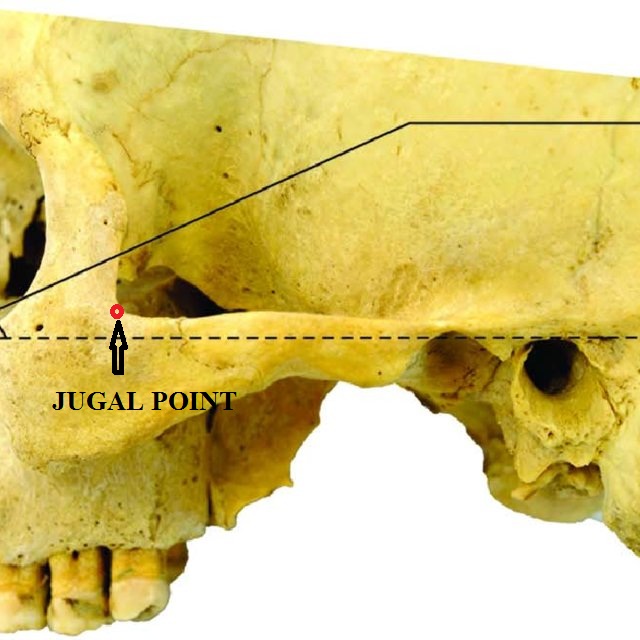 Image showing points that were utilized to derive various metrics in the present research.