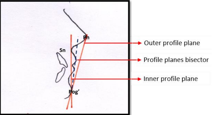 Soft tissue profile planes