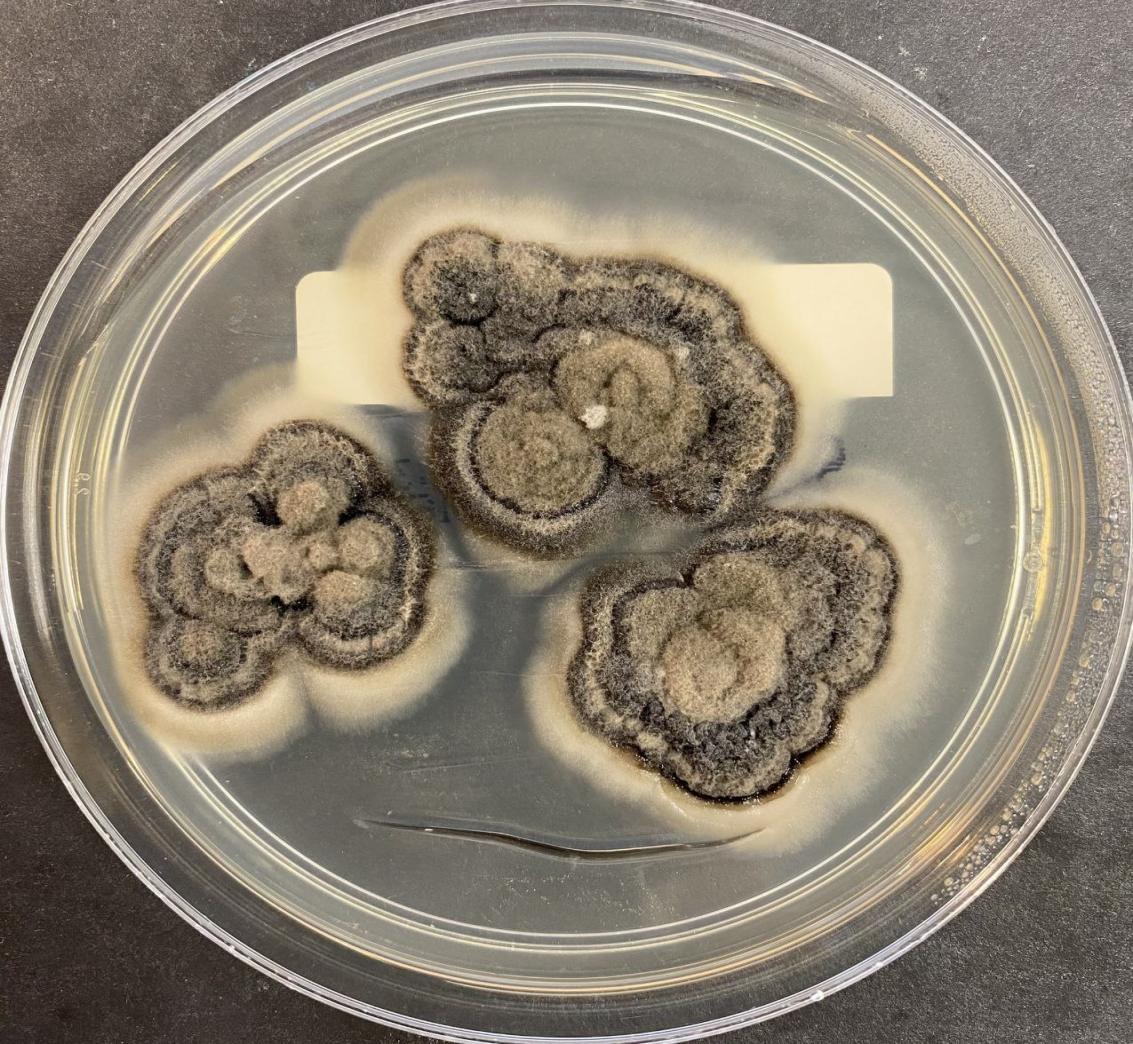 Sabouraud dextrose agar showing greyish-white wrinkled colonies of actinomycetoma (short arrow) with irregular margins (long arrow).