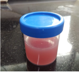 Urine gross examination