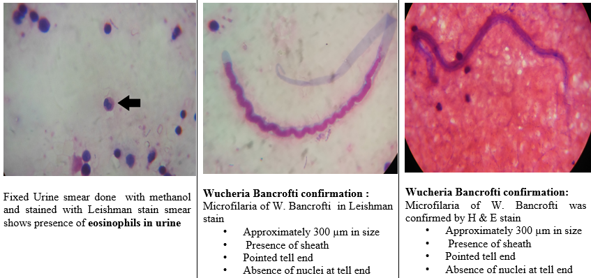 a; Leishman stainingshowing eosinophils, 5b; Lishmanstaining & 5c; H & Estaining