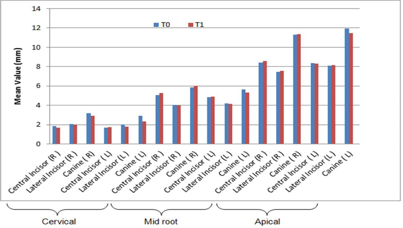 Change in overall alveolar bone thickness